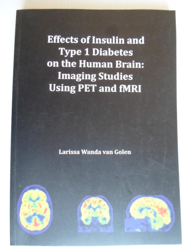 Golen, Larissa Wanda van - Effects of Insulin and Type 1 Diabetes on the Human Brain: Imaging Studies Using PET and fMRI, Proefschrift VU