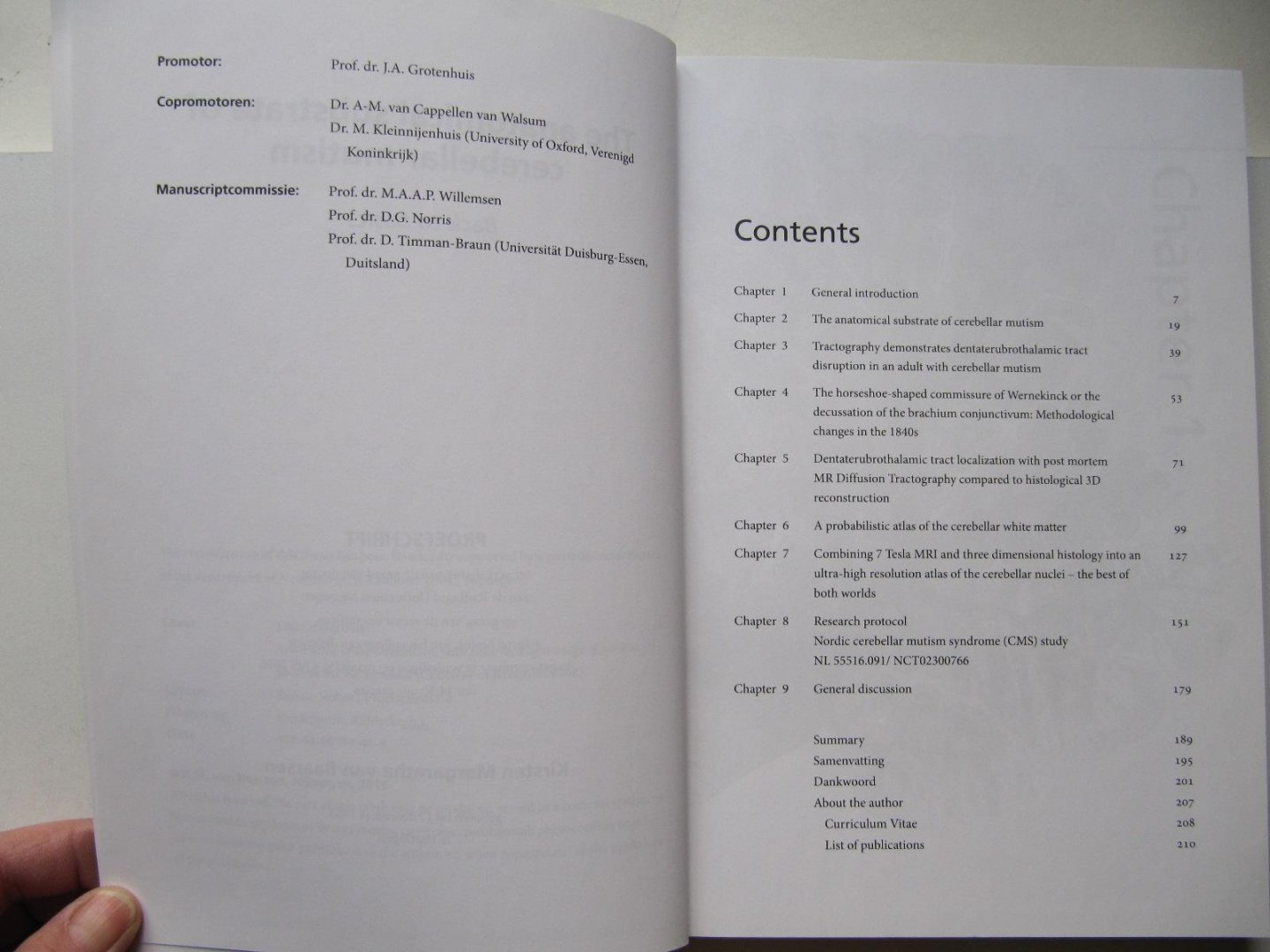 K.M. van Baarsen - The anatomical substrate of cerebellar mutism - Back to basics