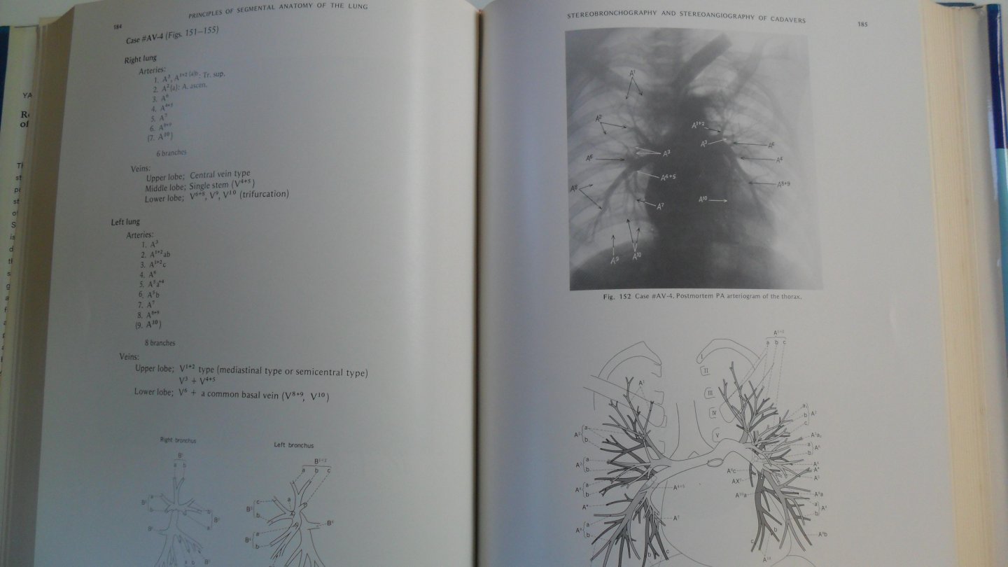 Yamashita Hideaki (M.D.) - Roentgenologic Anatomy of the Lung