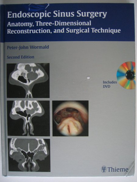 Wormald, Peter-John - Endoscopic Sinus Surgery - Anatomy, Three-dimensional Reconstruction, and Surgical Technique