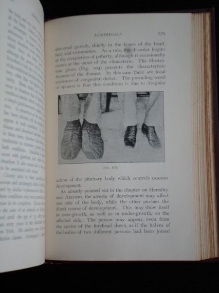 Talbot, Eugene S. - Degeneracy: Its Causes, Signs and Results, The Contemporary Science Series