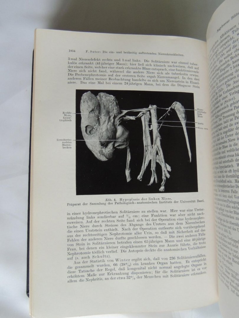 Mohr, Staehelin, Volhard, Suter - Handbuch der inneren Medizin - Nieren und Ableitende Harnwege