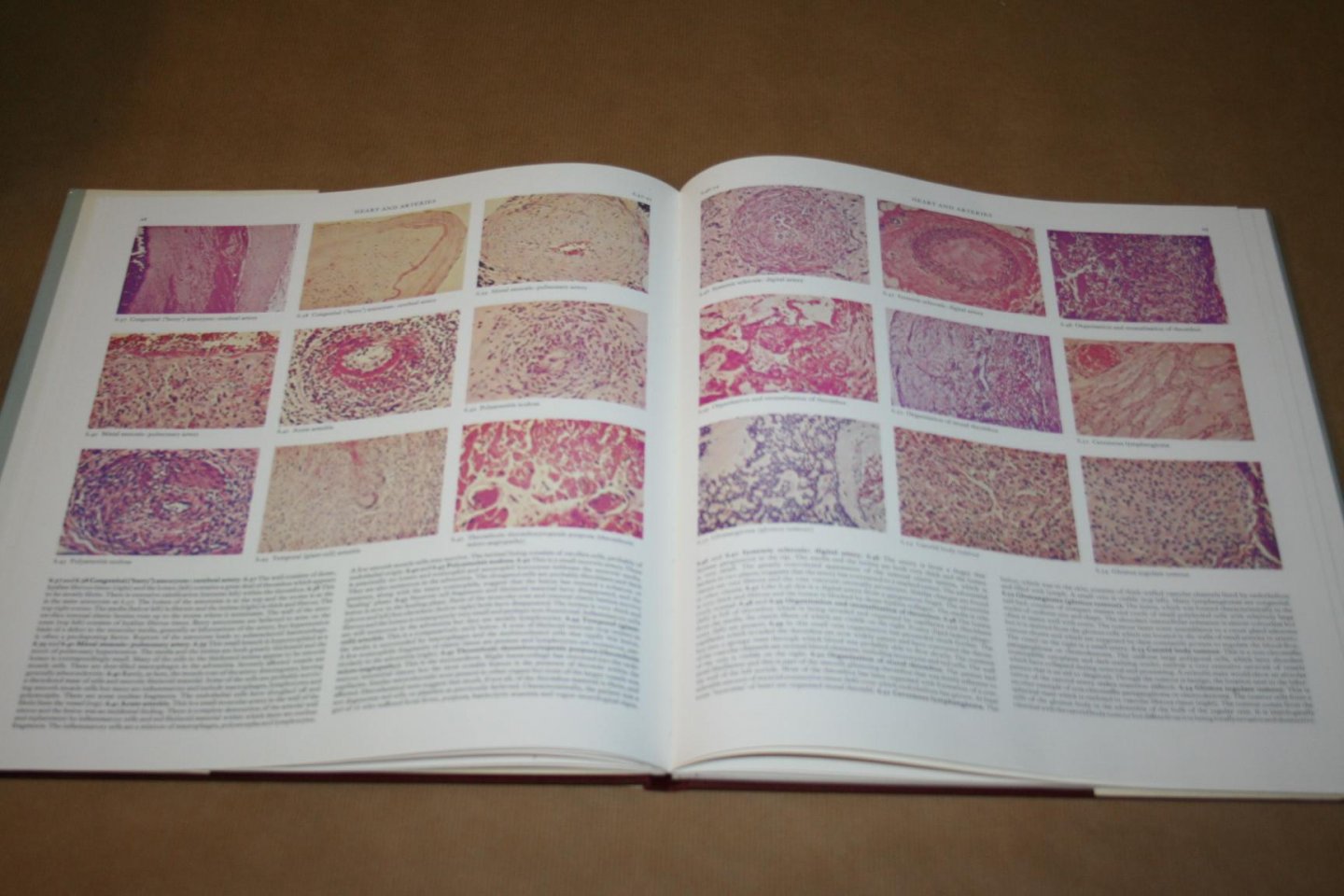 R.C. Curran - Colour Atlas of Histopathology  (with 765 Photomicrographs )