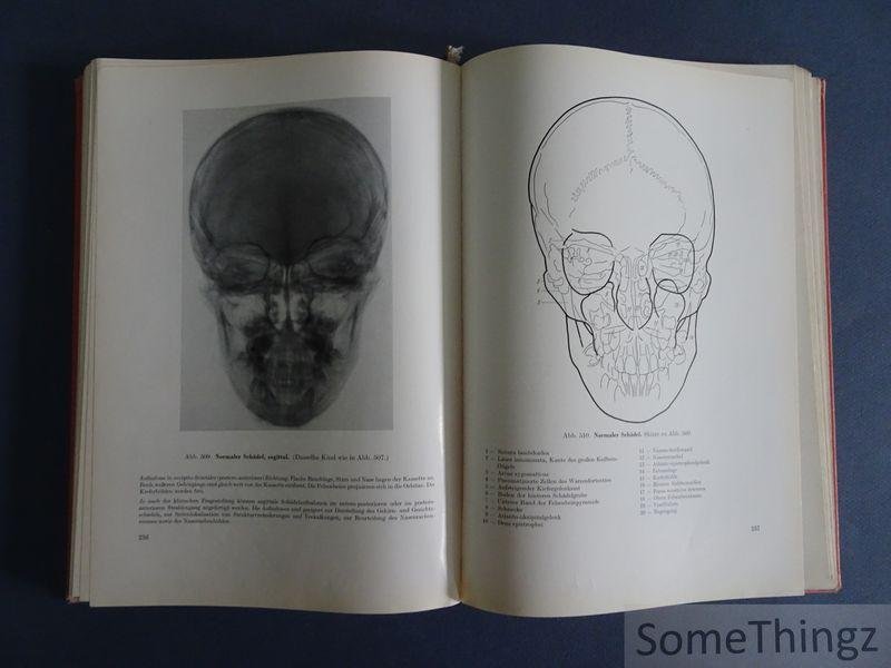 M.A. Lassrich, R. Prévot, K.H. Schäfer. - Pädiatrischer Röntgenatlas. Eine Sammlung typischer Bilder.