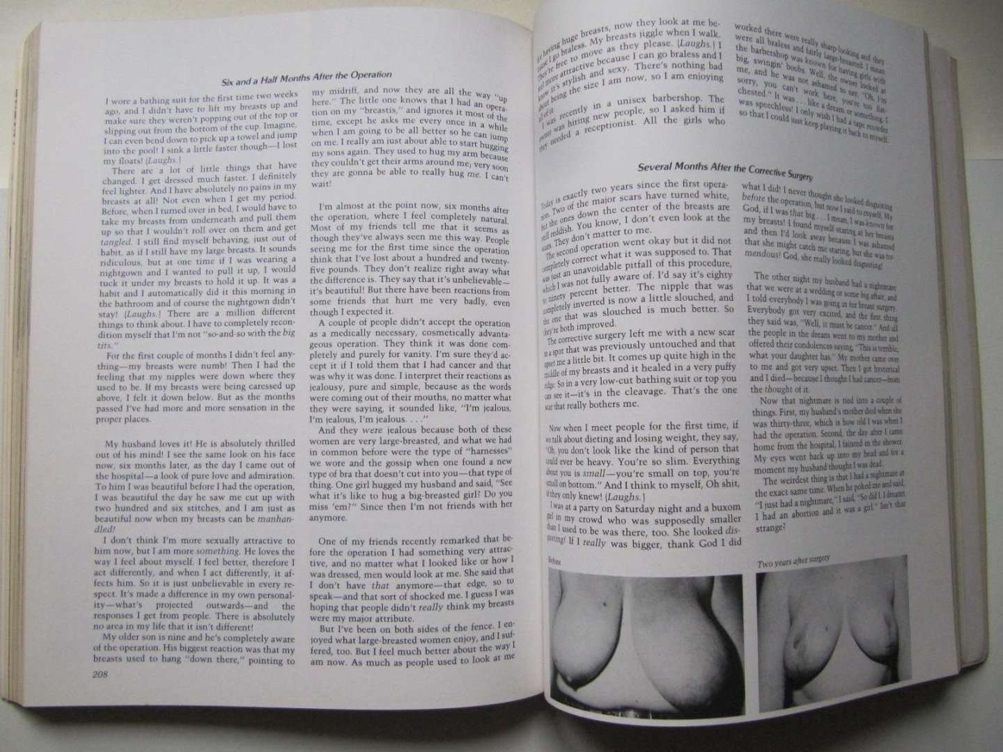 Daphna Ayalah and Isaac J. Weinstock - Breasts / Women speak about hteir breasts and their lives.