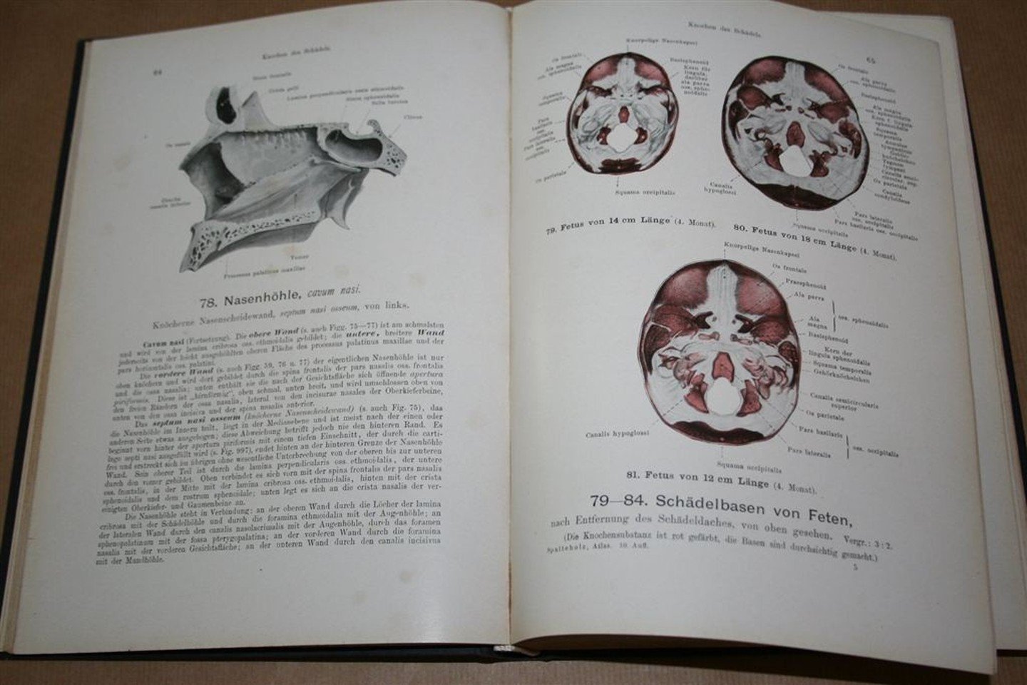 Werner Spalteholz, Wilhelm His - Handatlas der Anatomie des Menschen — Band. 1. Knochen, Gelenke, Bänder — Mit unterstützung von Wilhelm His