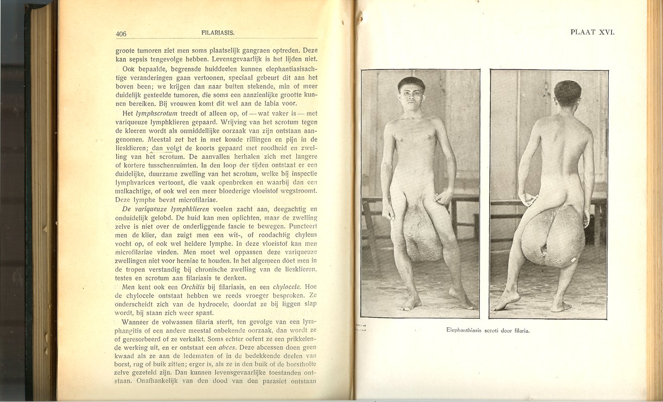 De Lange / Lichtenstein - Leerboek der tropische geneeskunde