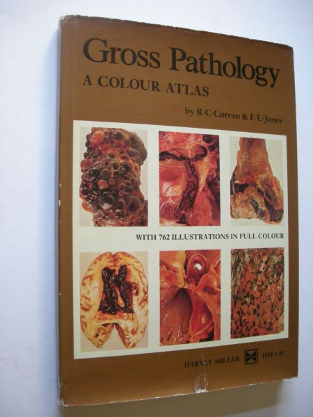 Curarn, R.C., & Jones, E.L. / Crawford, Prof.Sir Theo, foreword - Gross Pathology - A Colour Atlas