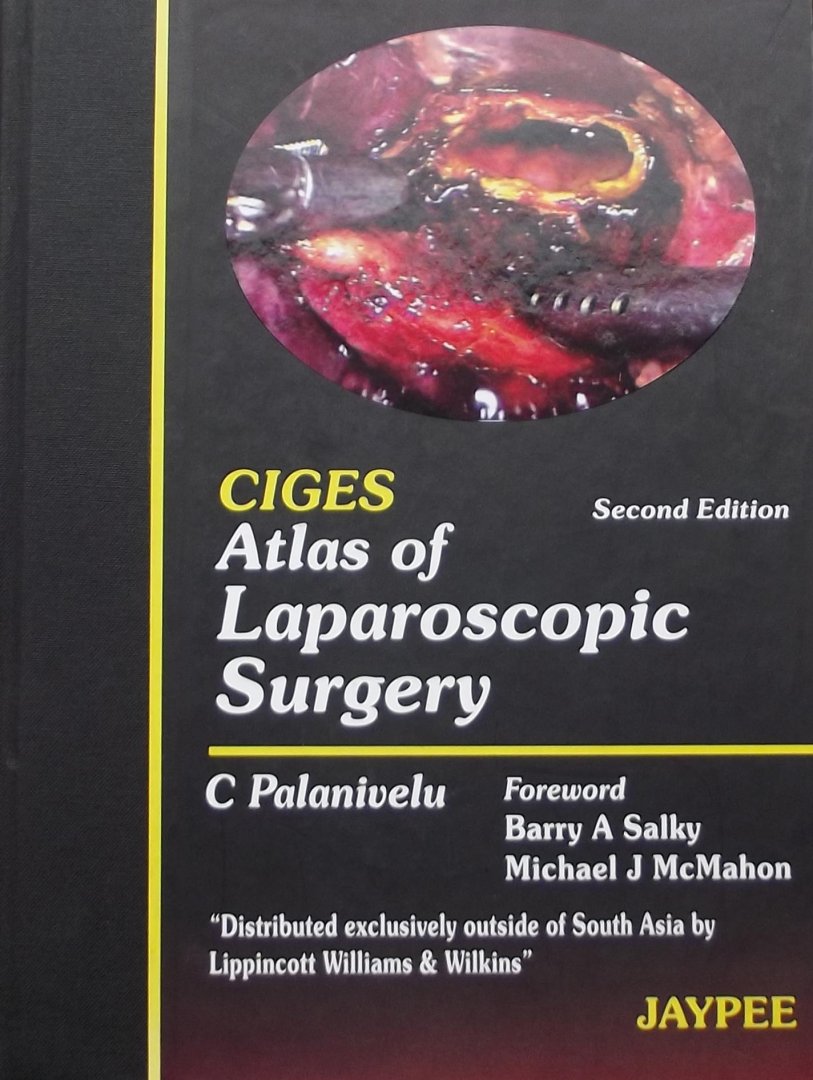 Palanivelu, C. - CIGES Atlas of Laparoscopic Surgery
