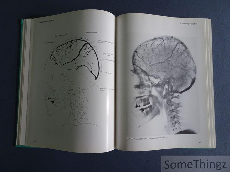 Lothar Wicke. - Atlas der Röntgenanatomie.