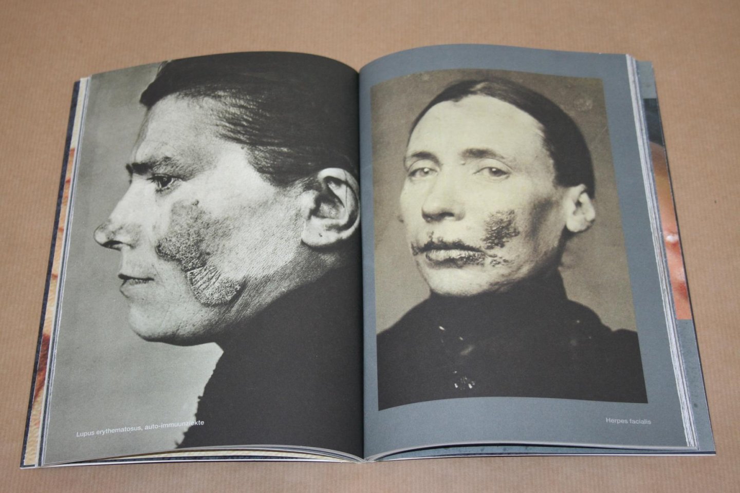 Adriaan van Dis & Mieneke te Hennepe - Enge dingen -- Het aangetaste lichaam