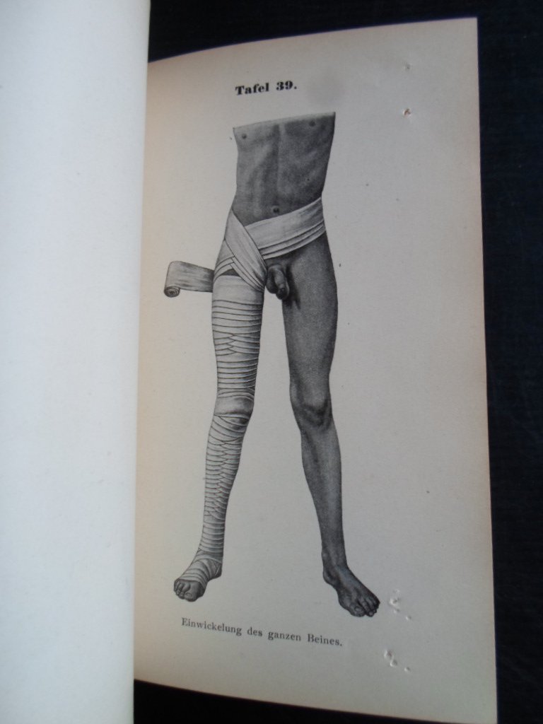 Hoffa, Dr.Albert - Atlass und Grundriss der Verbandlehre, Lehmann’s medicinische Handatlanten band XIII