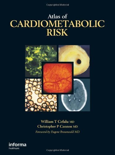 Cefalu , William T. & Cristopher P. Cannon . [ isbn 9780849370533 ] - Atlas of Cardiometabolic Risks . ( The first atlas devoted specifically to cardiometabolic risk, this book will provide a concise visual primer on the pathophysiology, epidemiology, diagnosis, treatment, and clinical and radiologic features of this -