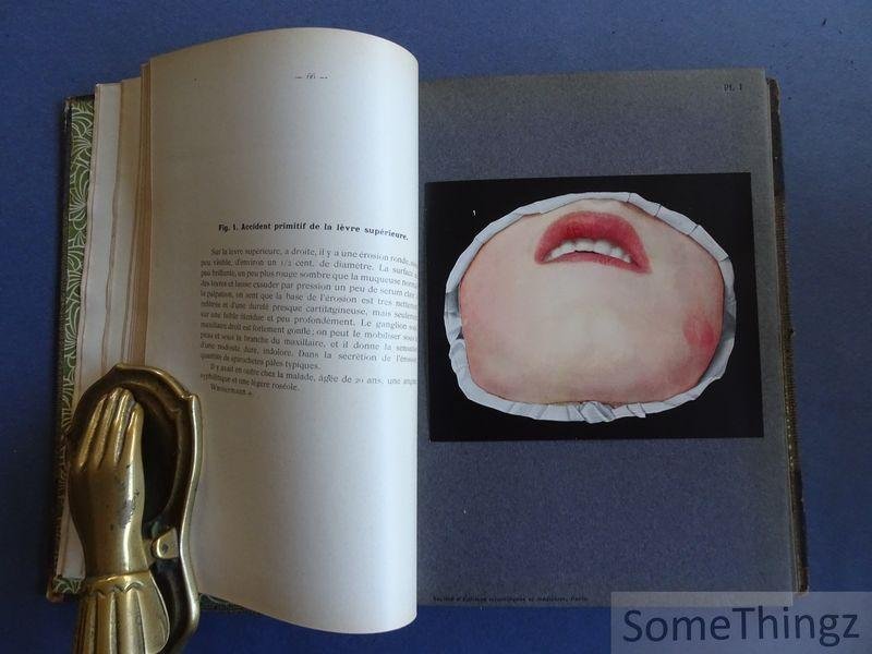 Fritz Zinsser / H. Bulliard (trad.) et Dr. Brocq (préface). - Syphilis de la bouche et affections analogues à l'usage des médecins, dentistes et étudiants. Édition française par le Dr H. Bulliard - Préface du Dr Brocq. Avec 51 filures en cuoleurs et 18 en noir en 44 planches.