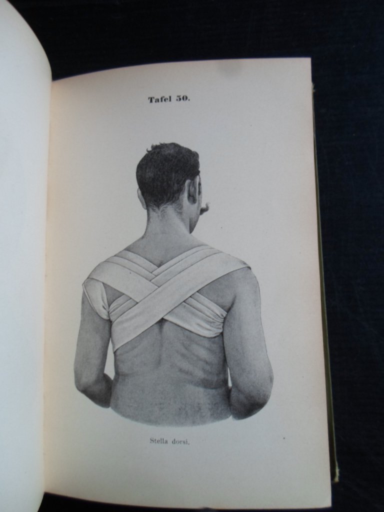 Hoffa, Dr.Albert - Atlass und Grundriss der Verbandlehre, Lehmann’s medicinische Handatlanten band XIII