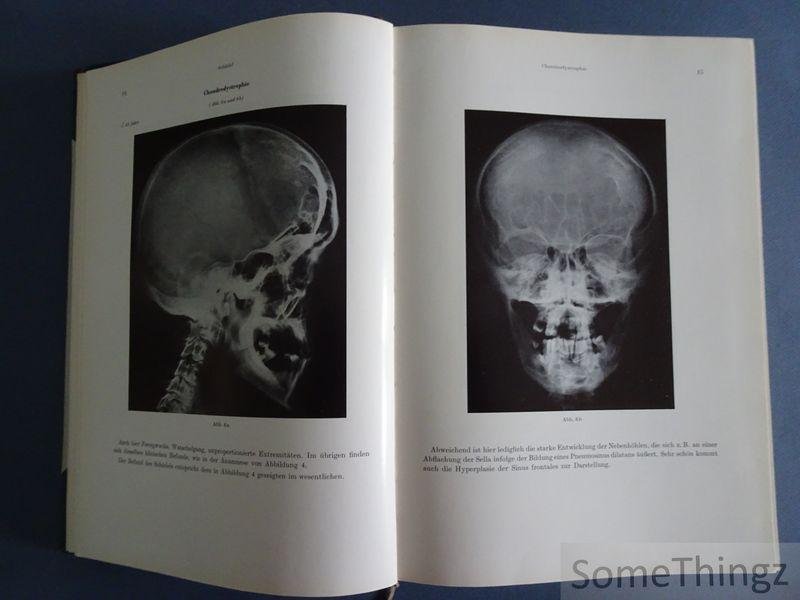 Hans Hellner und Hanno Poppe. - Röntgenologische Differntialdiagnose der Knochenerkrankungen.