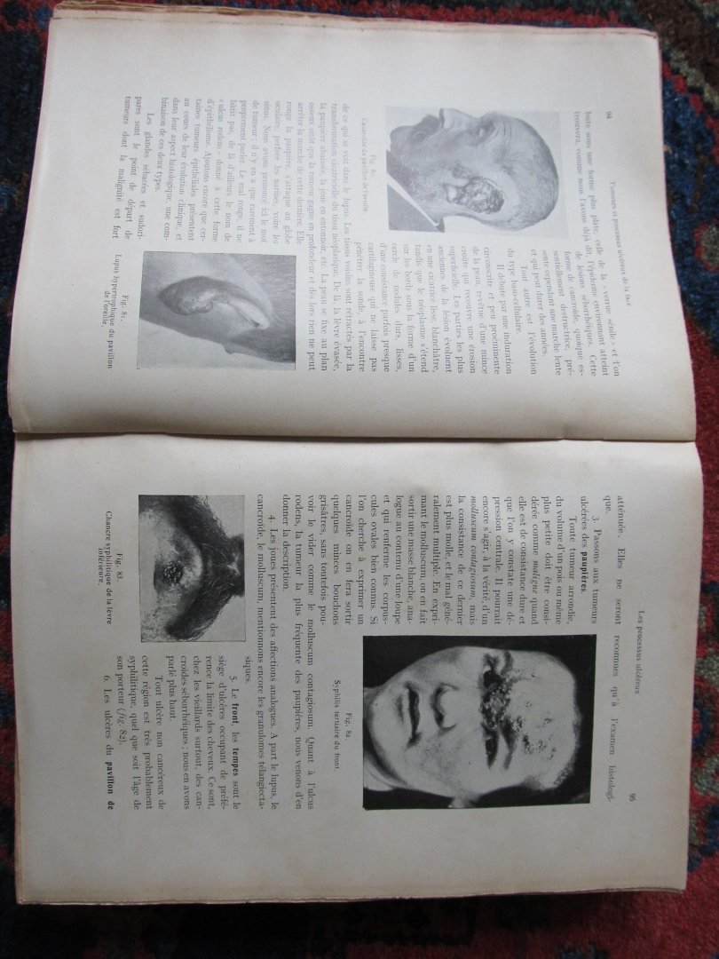 Quervain, F. de - TRAITÉ DE DIAGNOSTIC CHIRURGICAL
