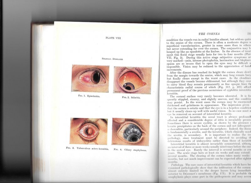 Duke-Elder, sir Stewart - Parsons'disease of the eye thirteenth edition