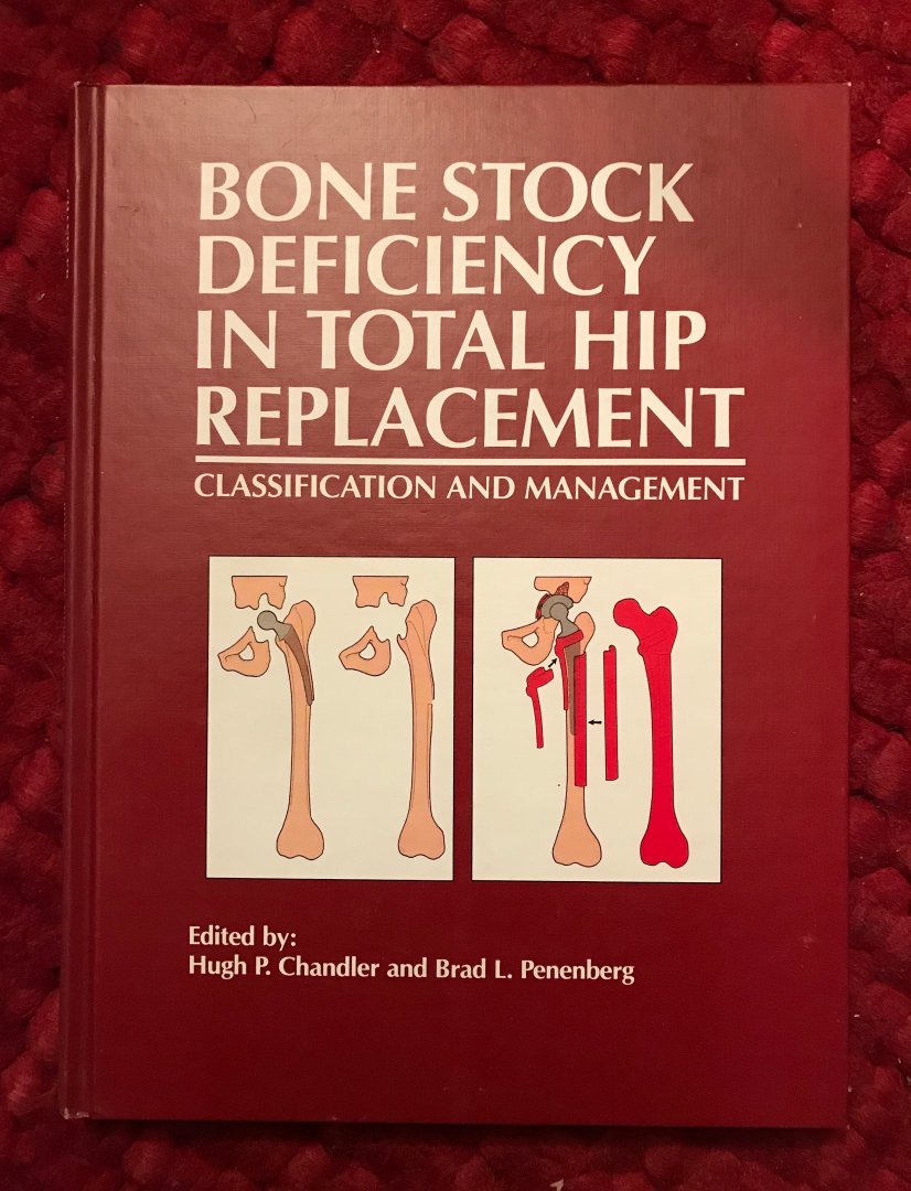 Chandler, Hugh P., Brad L. Penenberg - Bone stock deficiency in total hip replacement. Classification and management