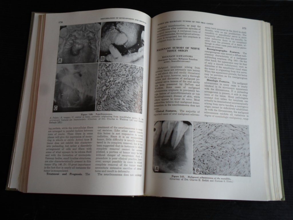 Shafer, W.G. & M.K.Hine & B.M.Levy - A Textbook of Oral Pathology