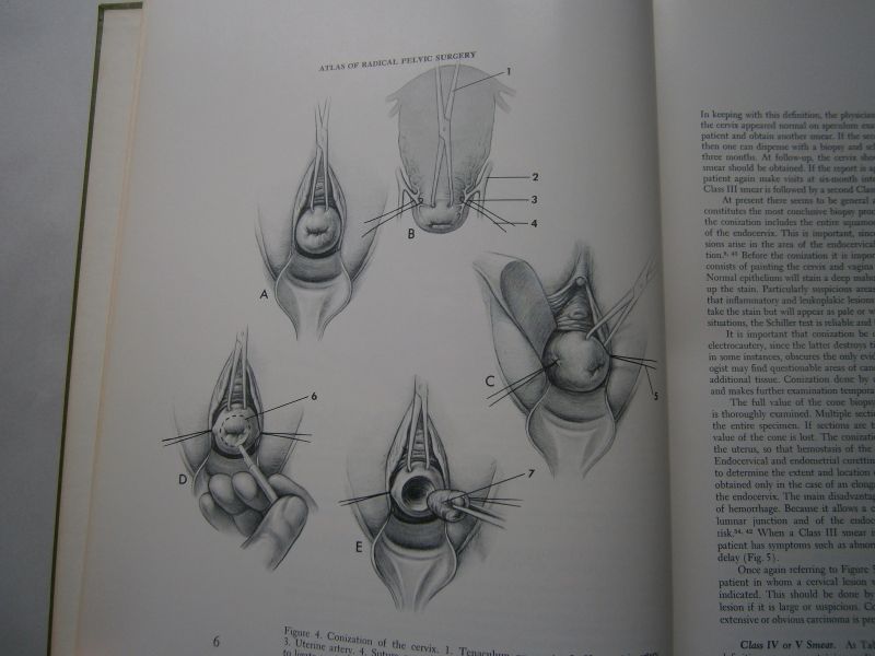 Nelson jr.  J.H. - Atlas of radical pelvic surgery
