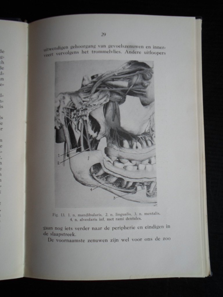 Vries, Dr.J.J.de - De gevoelloosmaking van tanden en kiezen in de onder-en bovenkaak