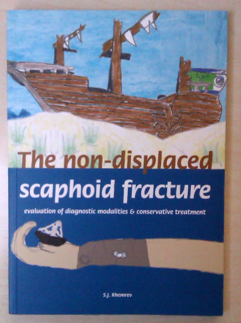 Steven Rhemrev - The Non-displaced Scaphoid Fracture: Evaluation of Diagnostic Modalities & Conservative Treatment