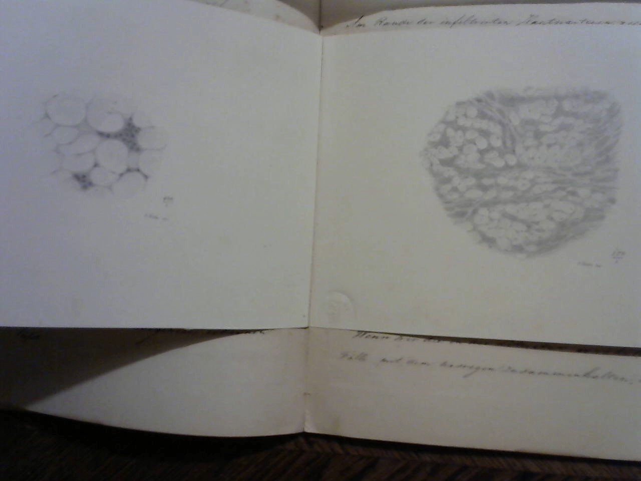 Fockens H. - Den Plattenformigen Hautkrebs, inaugural dissertation