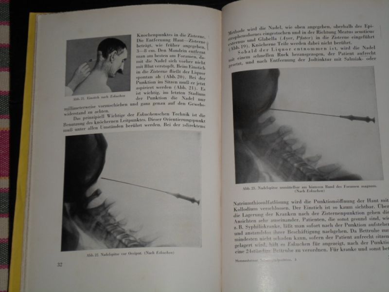 Memmesheimer, Alois M. - Die Technik und Anwendung der Suboccipital-oder Zisternenpunktion