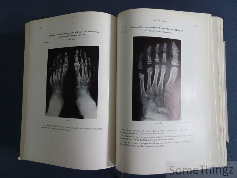 Hans Hellner und Hanno Poppe. - Röntgenologische Differntialdiagnose der Knochenerkrankungen.