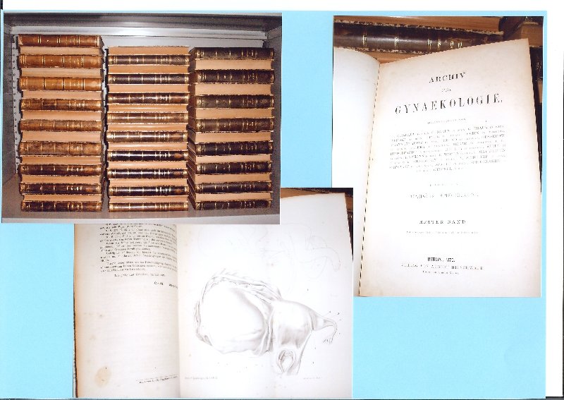 Credé und Spiegelberg - Archiv für gynaekologie