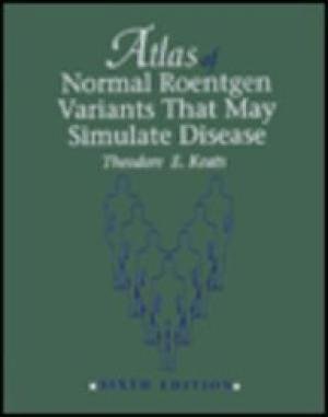 Keats, Theodore E. - Atlas of Normal Roentgen Variants That May Stimulate Disease
