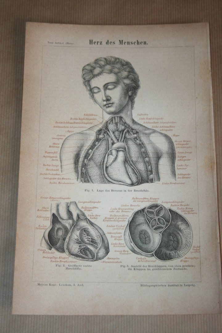  - Antieke prent - Anatomie van de mens - Hart van de mens - Circa 1875