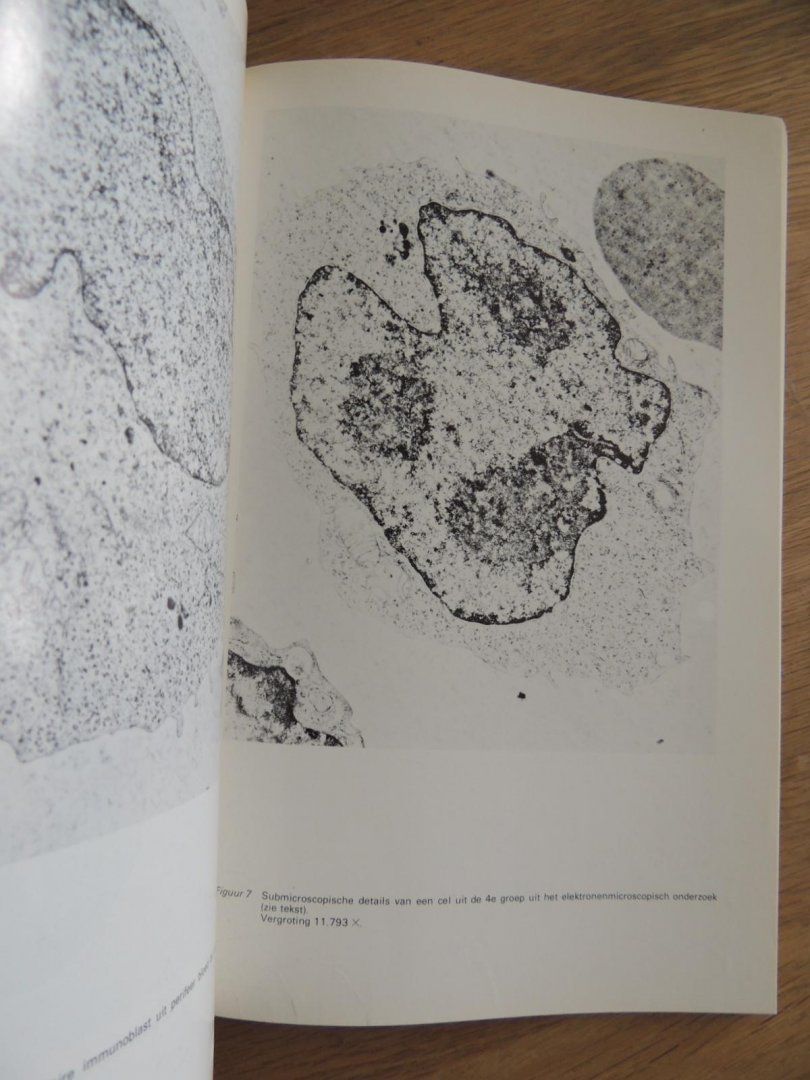 Hageman, Breur, Mijnsma, Rijssel van - redactie - Jaarboek kankeronderzoek en kankerbestrijding in Nederland = Yearbook for cancer research and fight against cancer in the Netherlands