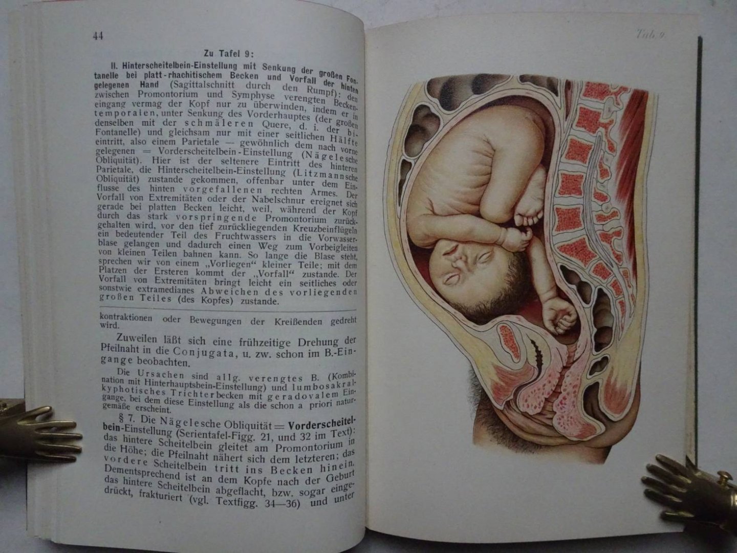 Schaeffer, Oskar. - Atlas und Grundriss der Lehre vom Geburtsakt und der operativen Geburtshilfe.