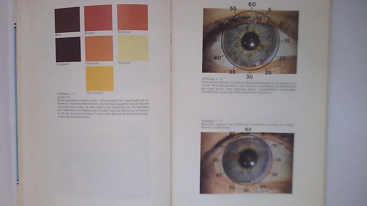 Lindemann, Günther - Augendiagnostik. Befunderherbung aus dem Auge.( Lehrbuch)