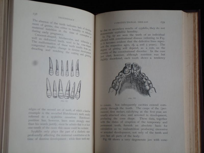 Talbot, Eugene S. - Degeneracy: Its Causes, Signs and Results, The Contemporary Science Series