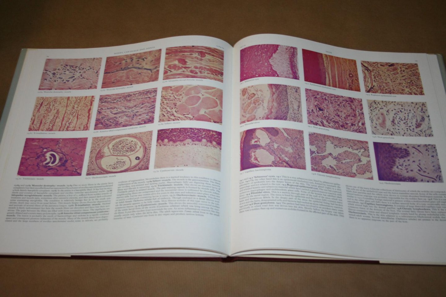 R.C. Curran - Colour Atlas of Histopathology  (with 765 Photomicrographs )