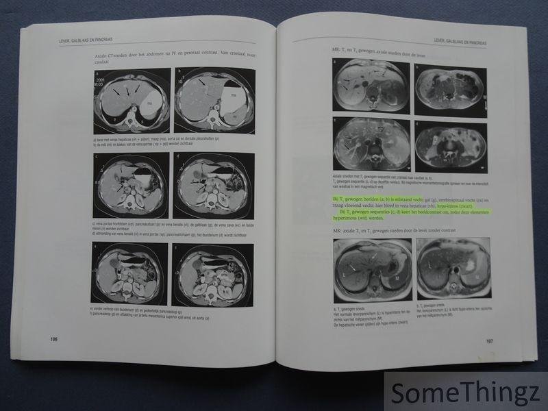 Verschakelen, Johny en Oyen, Raymond. - Inleiding tot de radiologische anatomie