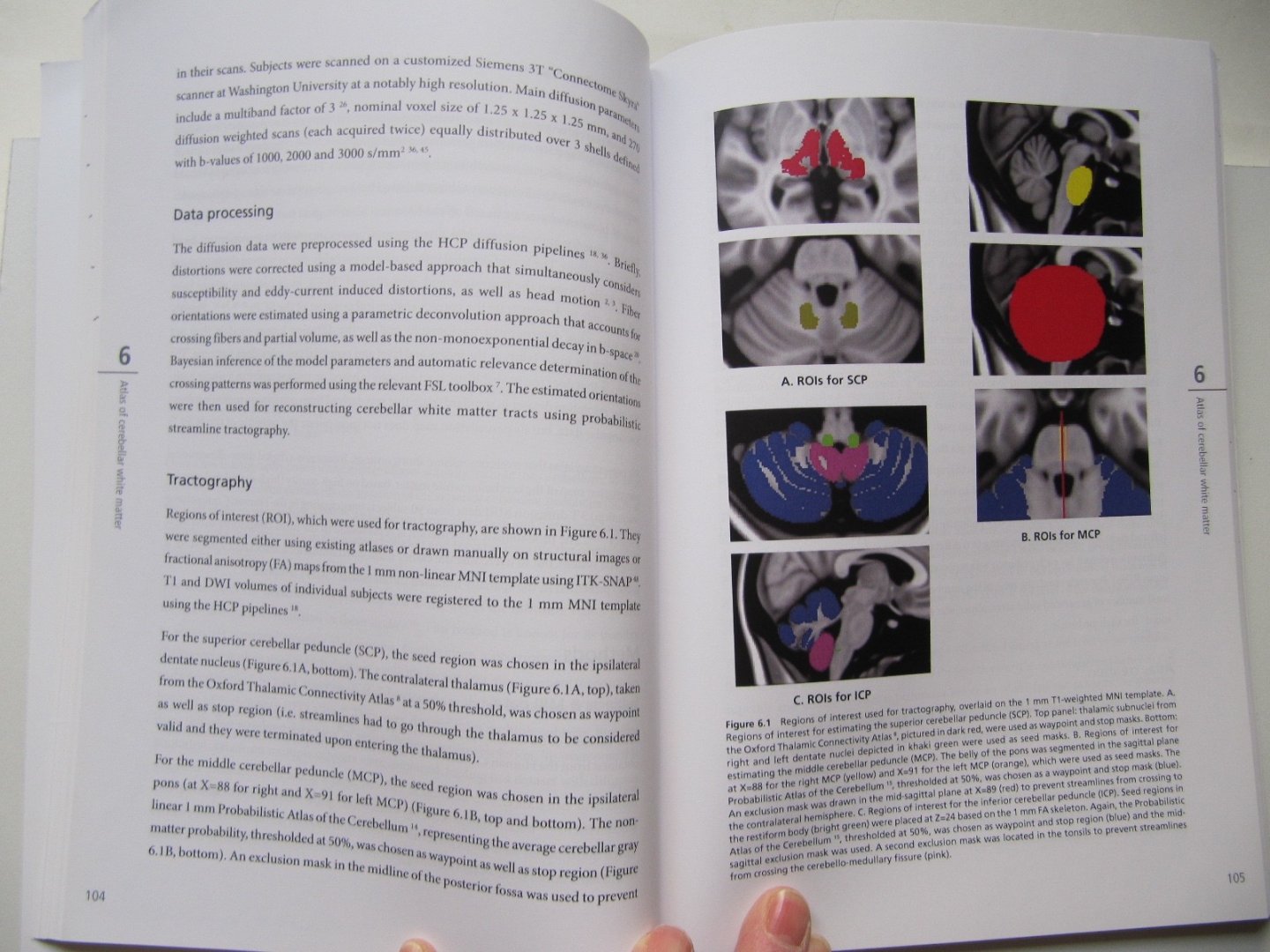 K.M. van Baarsen - The anatomical substrate of cerebellar mutism - Back to basics