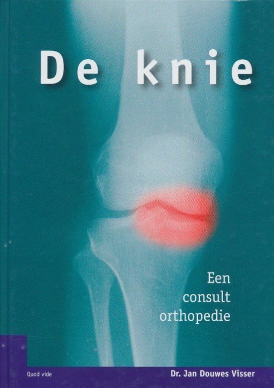 Visser, Jan Douwes - De  knie. Een consult orthopedie