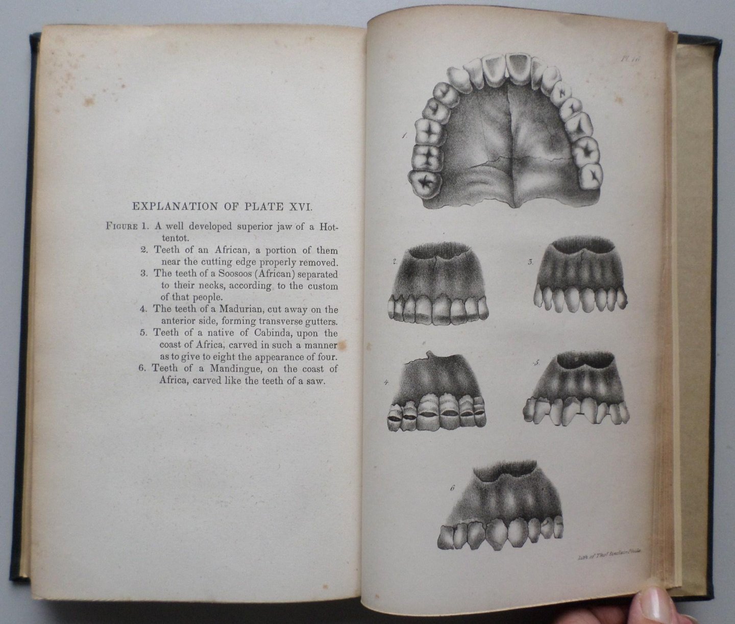 Maury, F. - Treatise on the Dental Art, founded on actual experience. Translated from the French with notes and additions, by J.B.Savier