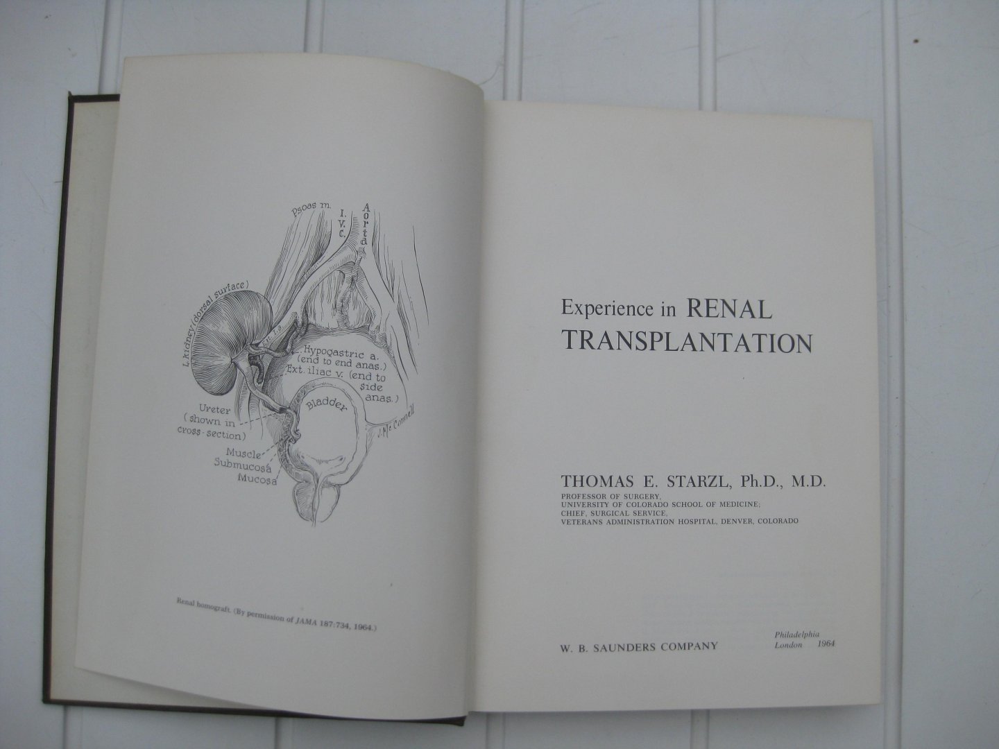 Starzl, Thomas E. - Experience in Renal Transplantation.
