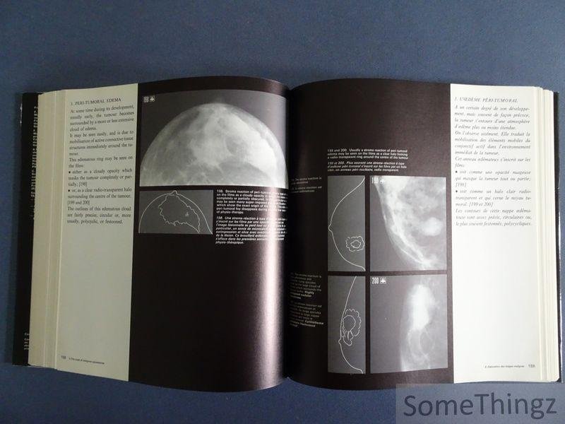 A. Willemin. - Mammographic appearances. / Les images mammographiques.