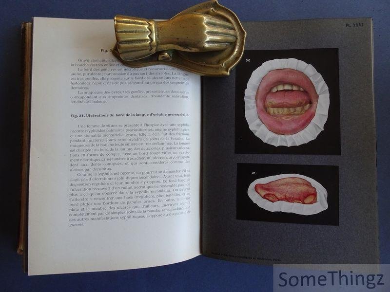 Fritz Zinsser / H. Bulliard (trad.) et Dr. Brocq (préface). - Syphilis de la bouche et affections analogues à l'usage des médecins, dentistes et étudiants. Édition française par le Dr H. Bulliard - Préface du Dr Brocq. Avec 51 filures en cuoleurs et 18 en noir en 44 planches.