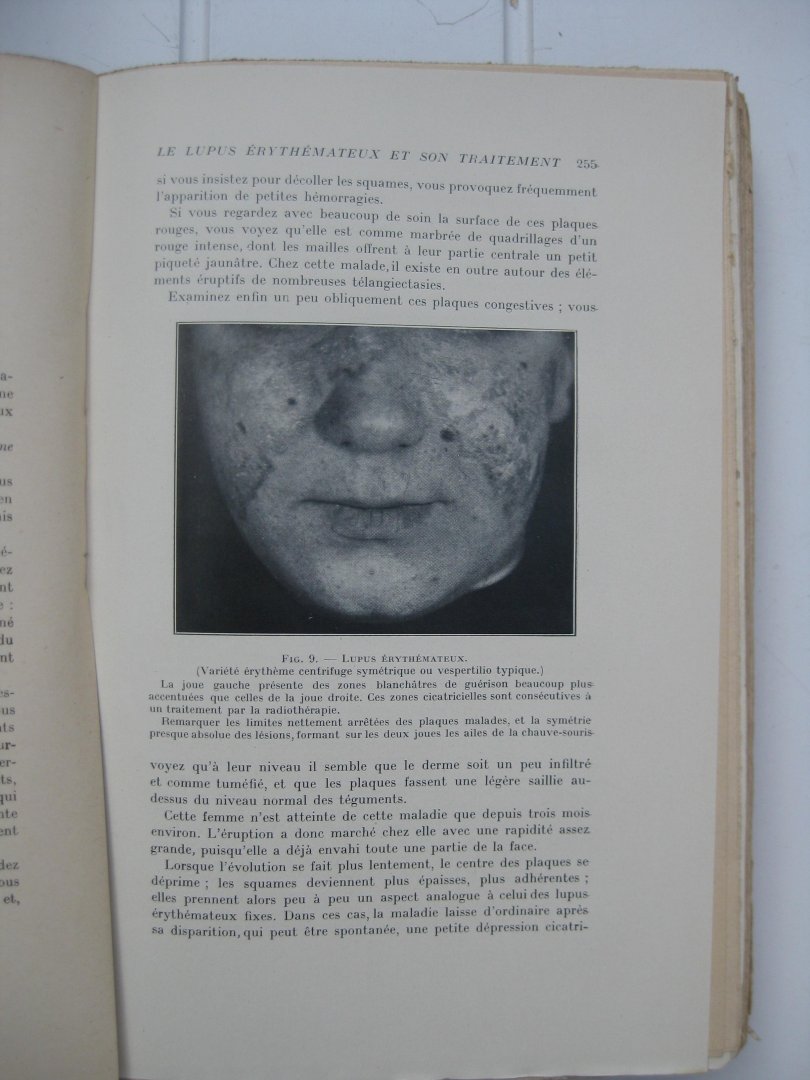 Brocq, L. - Cliniques Dermatologiques.