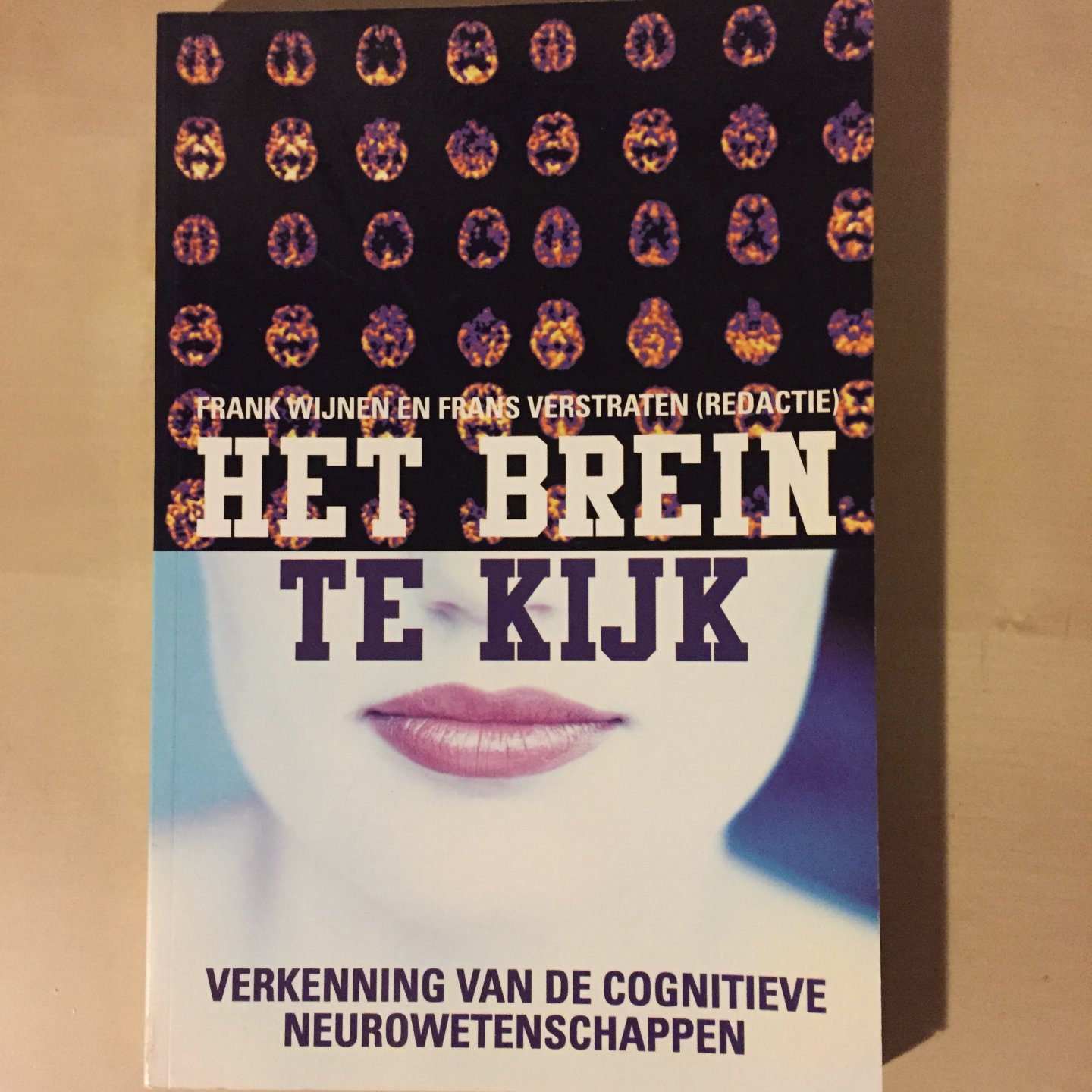 Wijnen, F. / Verstraten, F. - Het brein te kijk / verkenning van de cognitieve neurowetenschappen