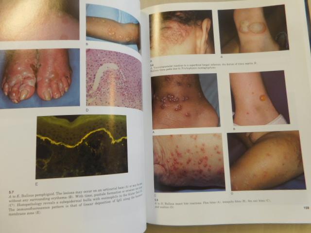 Callen Jeffrey P.// Kenneth E. Greer// Antoinette F. Hood // Amy S. Paller // Leonard J. Swinyer  (professors) - Color Atlas of Dermatology