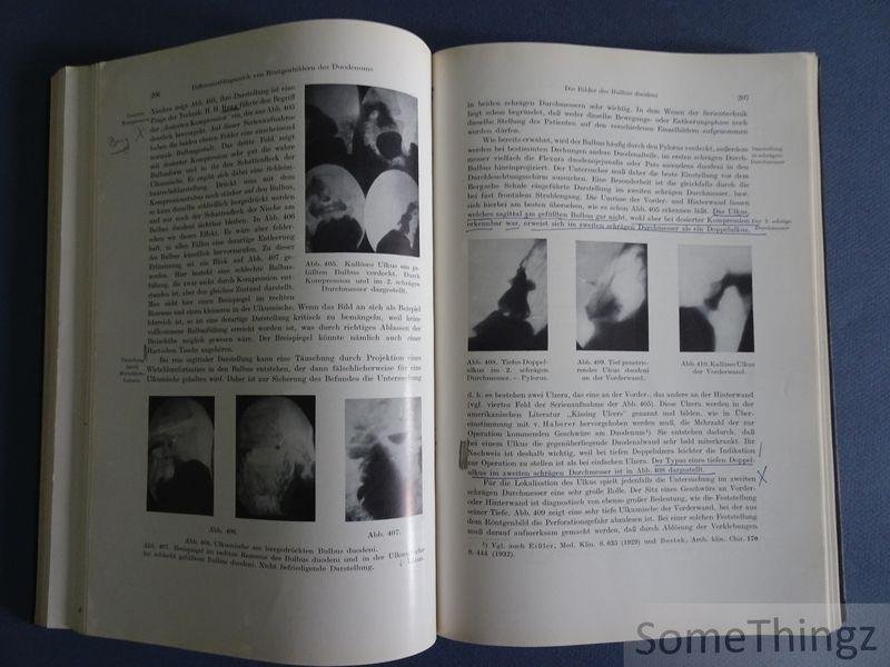 Teschendorf, Werner - Lehrbuch der röntgenologischen Differentialdiagnostik der Erkrankungen der Bauchorgane.