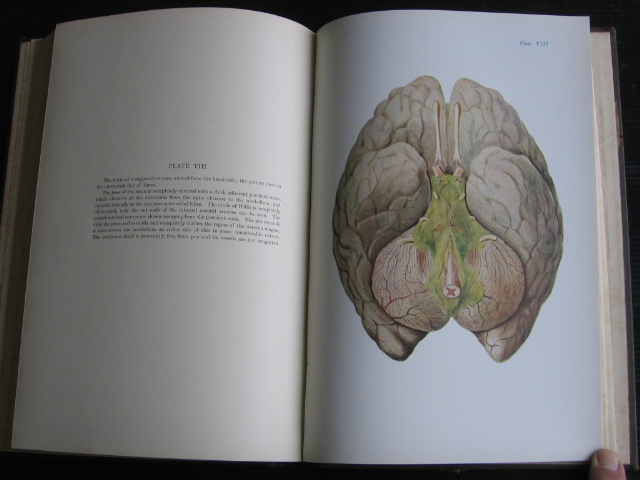 Foster, M. & J.F.Gaskell - Cerebro-Spinal Fever